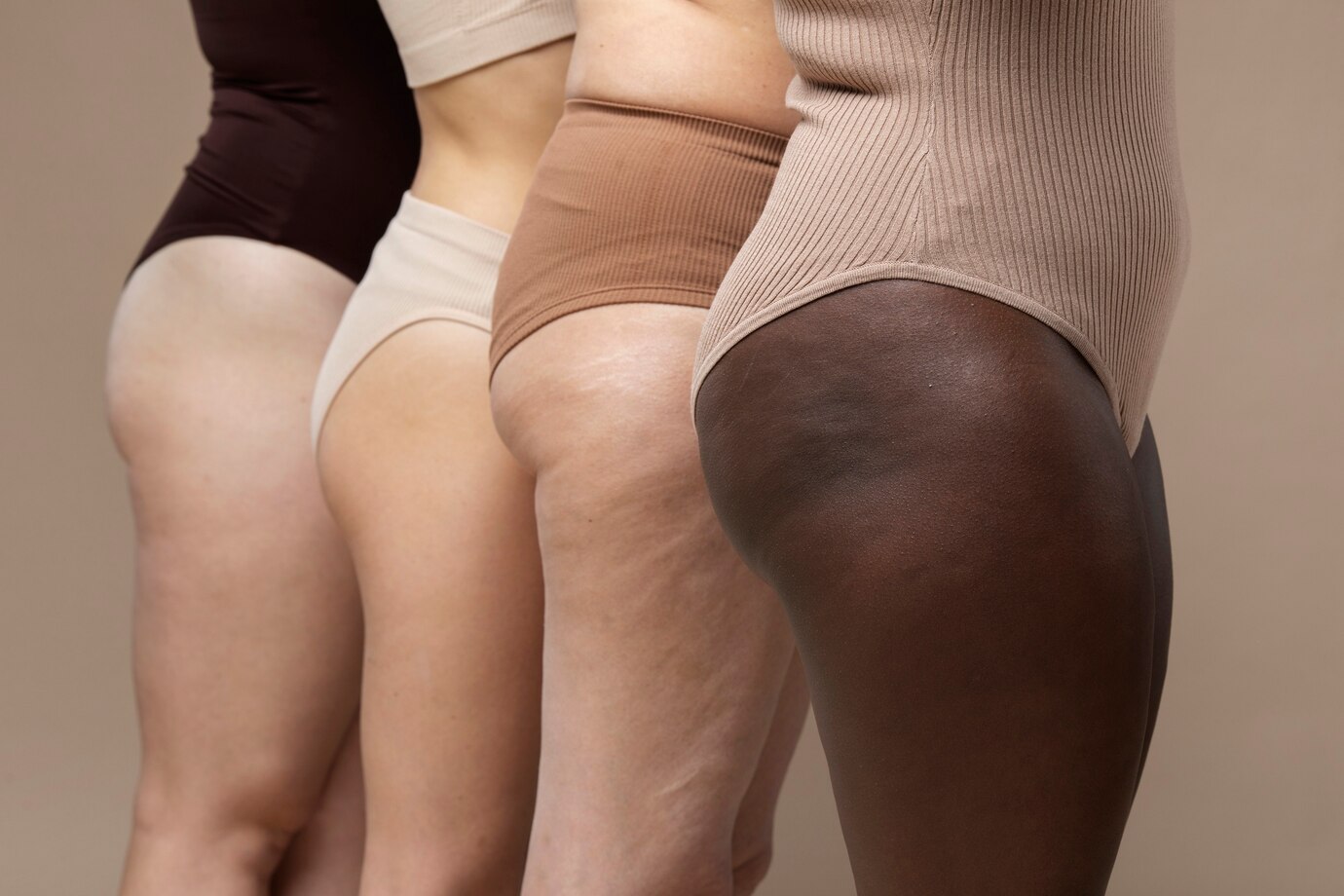 lipedema e obesidade