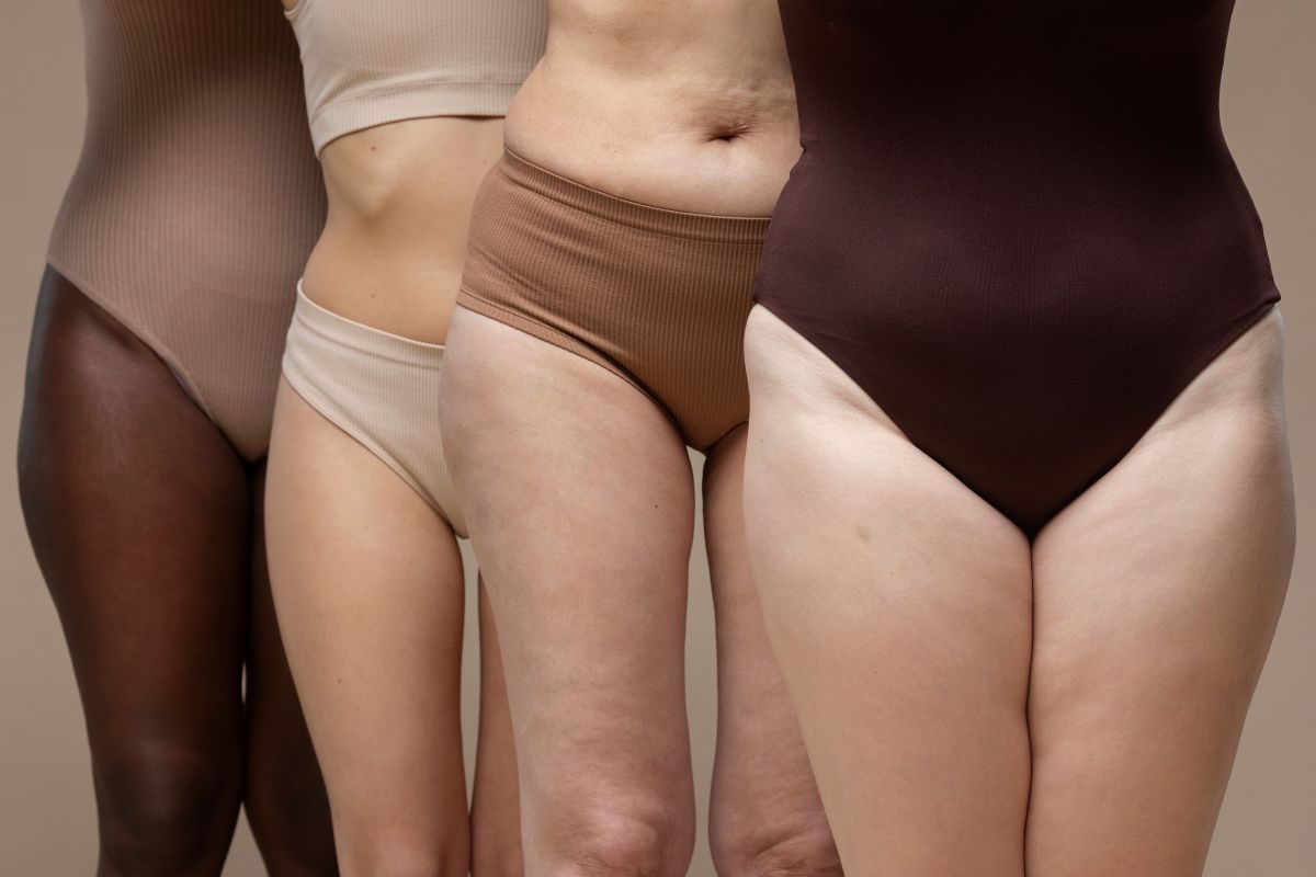 Lipedema em diferentes estágios da vida