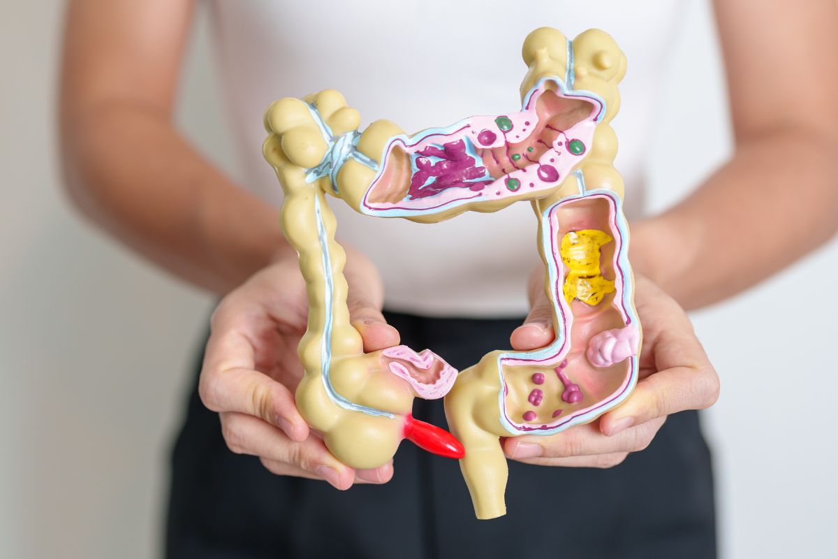 Obesidade e microbioma intestinal