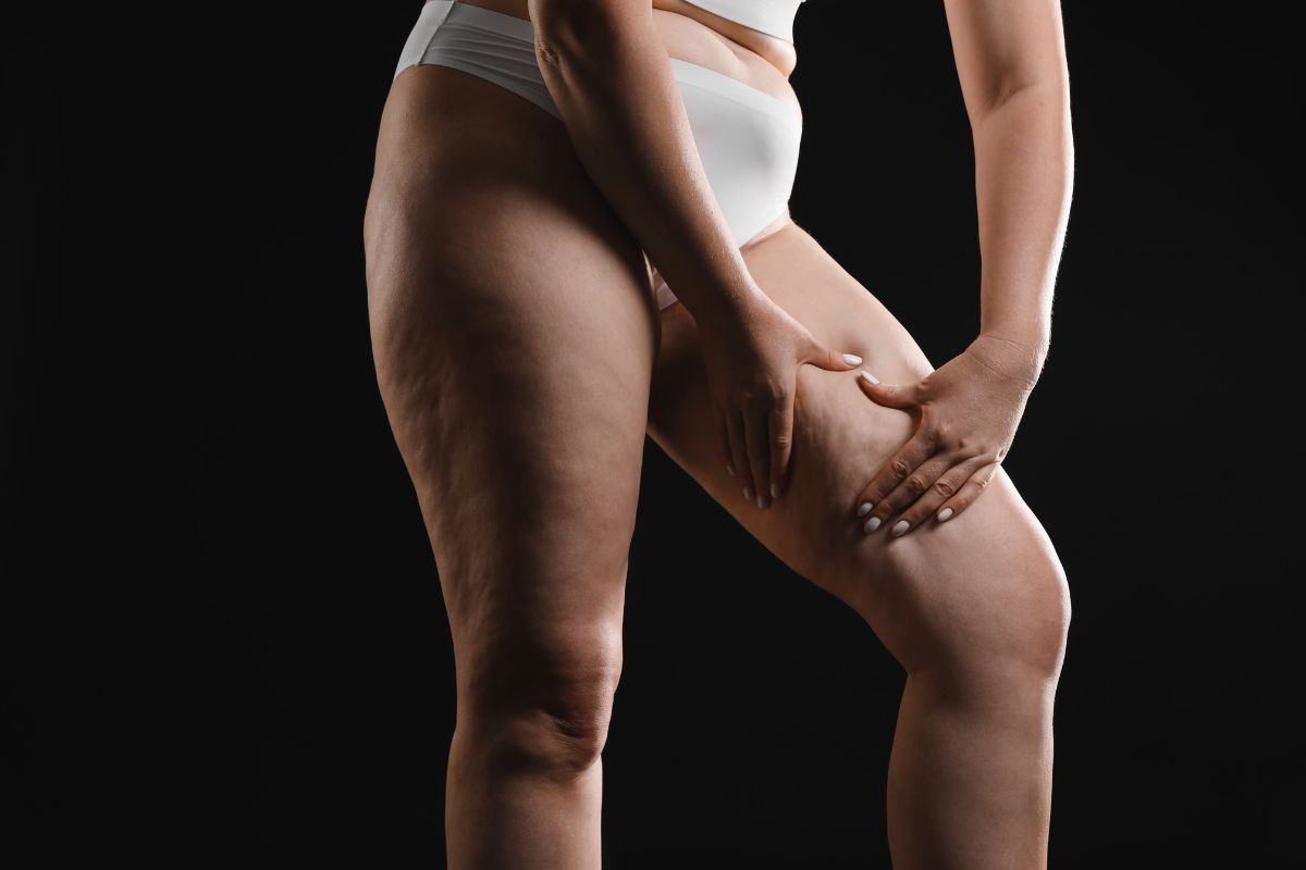 exame de lipedema
